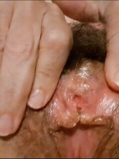 Mia moglie viene visitata da un dottore