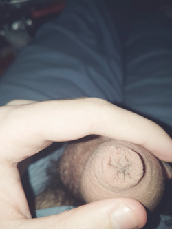 Il mio pisello 2