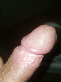 Il mio Parte 10