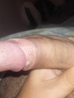Salve