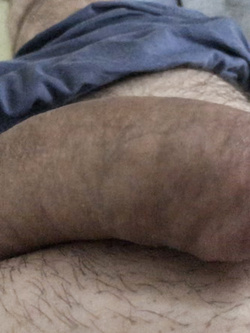 Dettagli