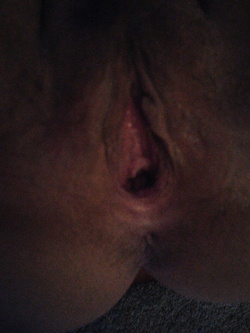 Parte2