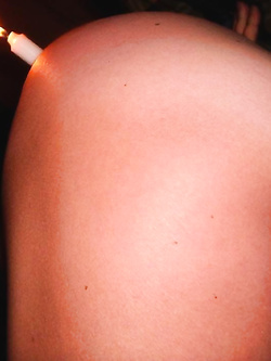 Dilatazione 2
