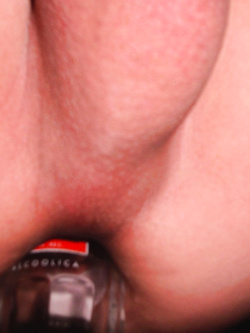 Dilatazione 2
