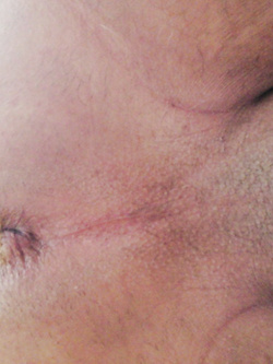 Seghe e culi