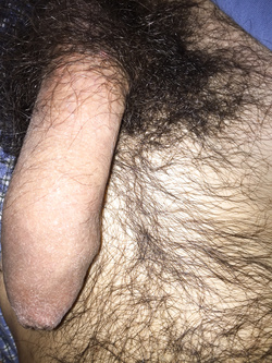 Il mio Parte 4
