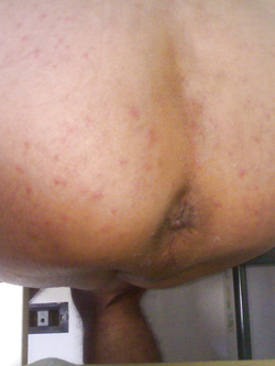 ...vi accolgo a chiappe aperte.....