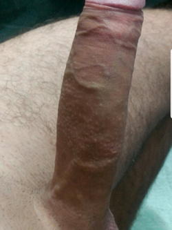 Me 