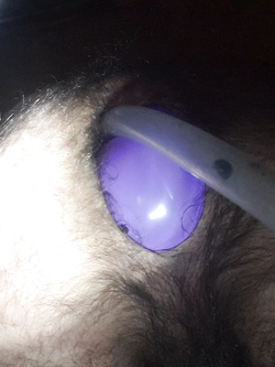 Dilatazione Parte 2