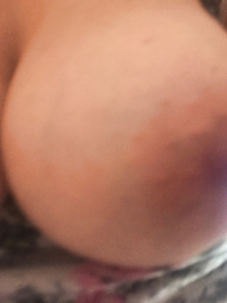 Tette Parte 2
