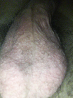 Il mio pene Parte 3