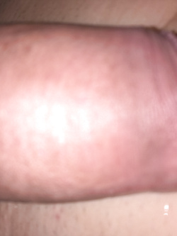 Mio cazzone