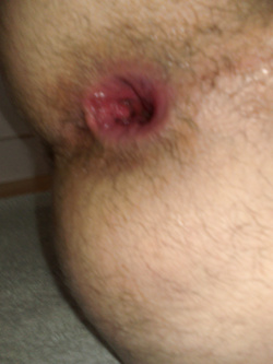 il mio culetto