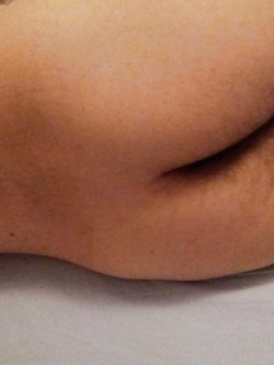 Me@@@