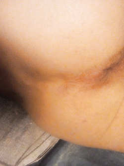 Culetto Parte 9