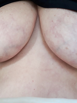 Per voi... Parte 44