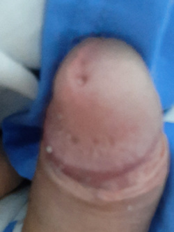 Moscio Parte 3