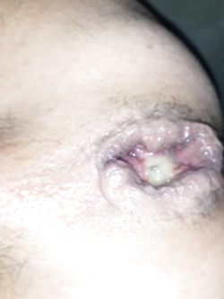 fukme
