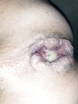 fukme