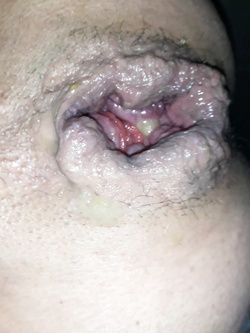 fukme