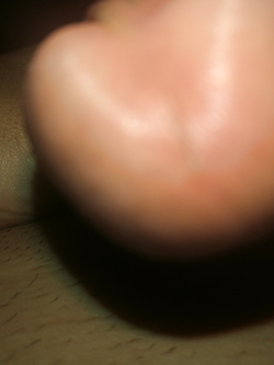 Cazzo pazzo