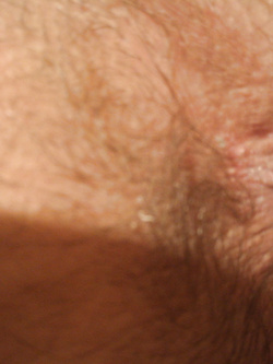 Cazzo pazzo