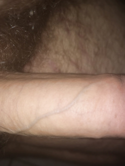 My Dick