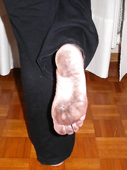 Piedi con piante callose e sporche