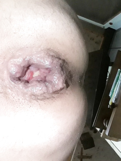Pussy anal Parte 2