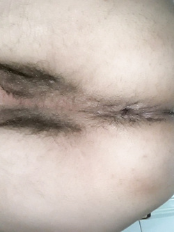 self hole