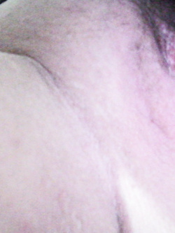 il mio pene