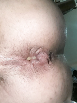 self ass Parte 4