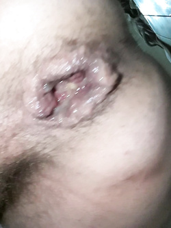 vagin ass
