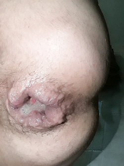 anal cum