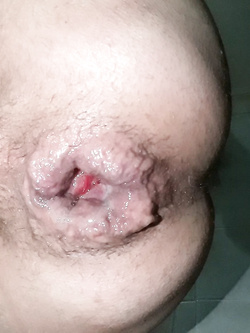 anal cum