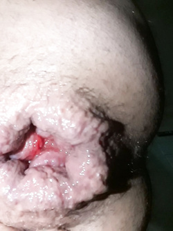 anal cum