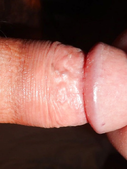 TEST DELLA MONETA SULLA CAPPELLA.