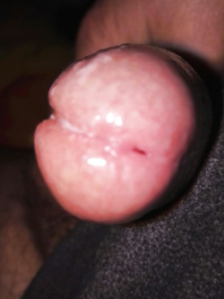 X le vostre