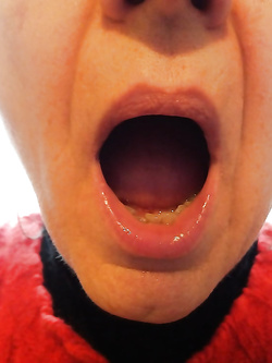 Buchi diversi, ma sempre buchi