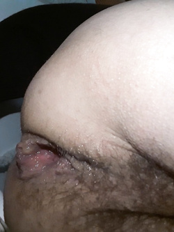vagina aperta