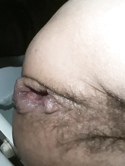 vagina aperta