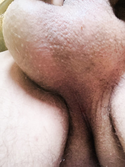 Depilazione