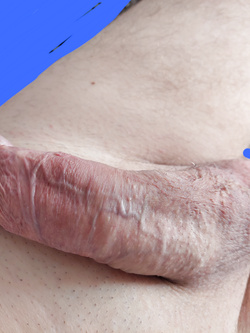 IO e i miei gioielli