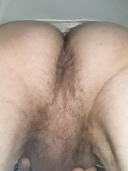 anal vision