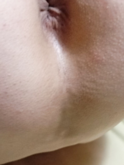 the ass Parte 3