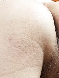 the ass Parte 6