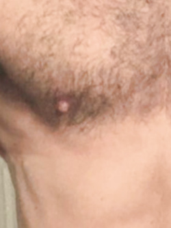 album1 Parte 2