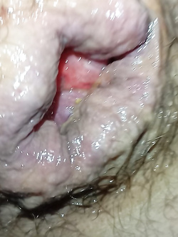 ass 2 Parte 6