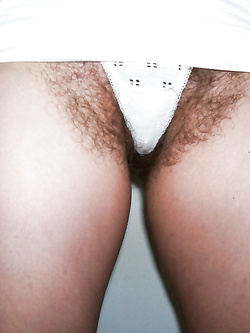Il pelo