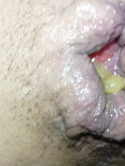 candid ass toples Parte 6